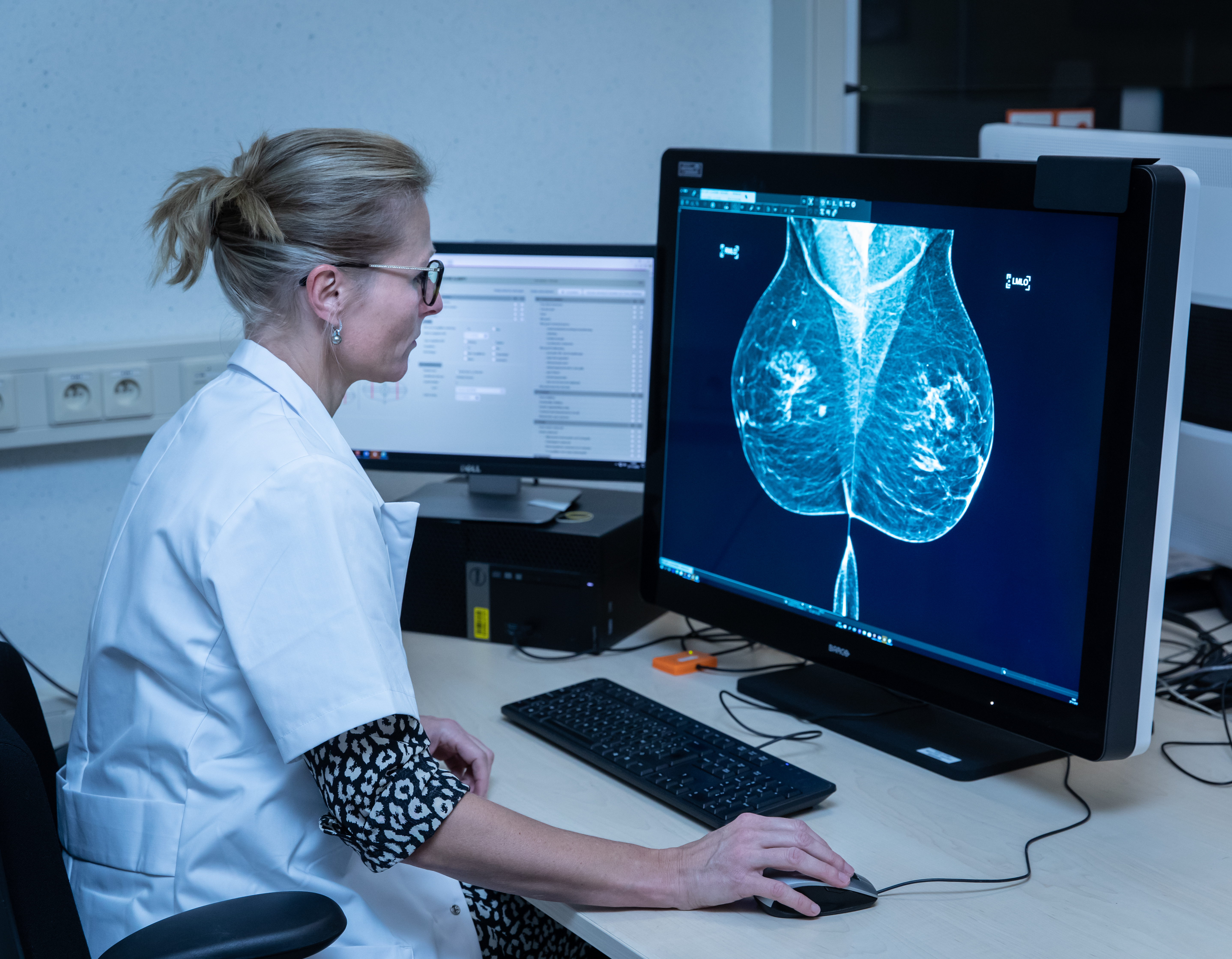Lezer beoordeelt de mammografiebeelden